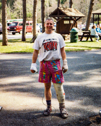 Skip and his broken bones